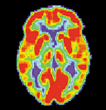 petbrain